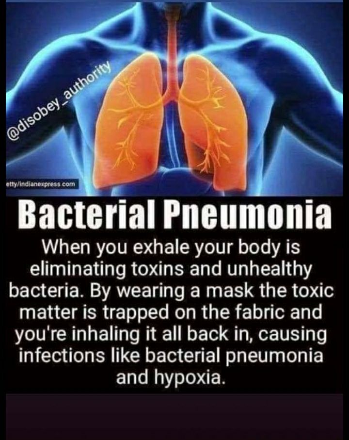 Prolonged Masks Cause Bacterial Pneumonia